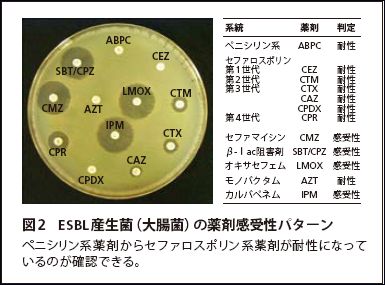 図2　ESBL産生菌（大腸菌）の薬剤感受性パターン